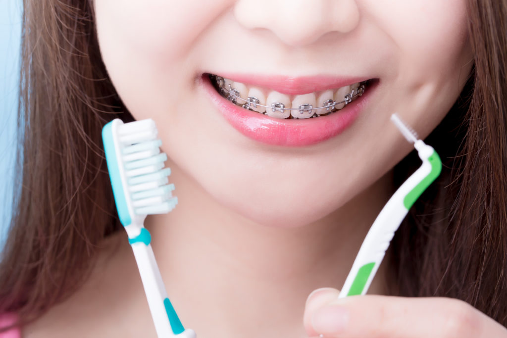 soins orthodontiste Hygiène bucale